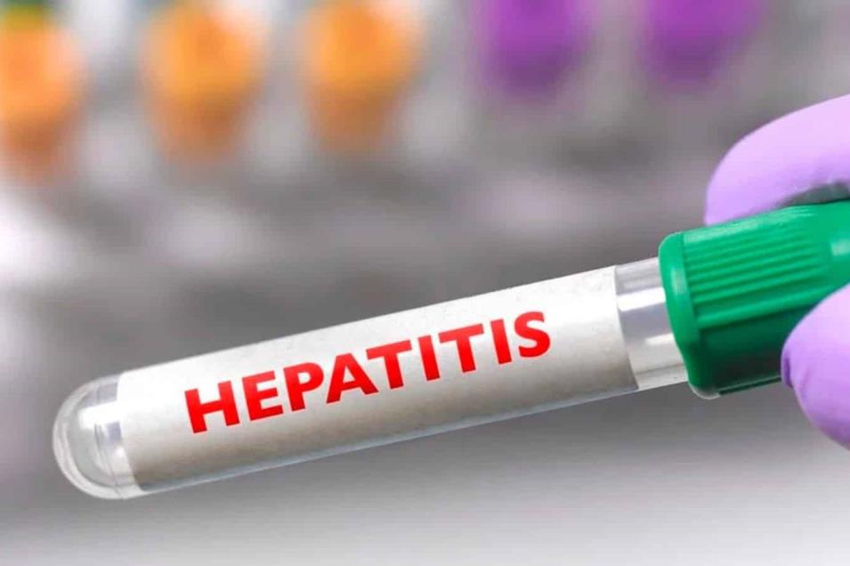 Reportan Nuevo Caso Sospechoso De Hepatitis Aguda Gavre Focus 0 0 955 636