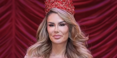 Ninel Conde explains her decision to undergo keratopigmentation