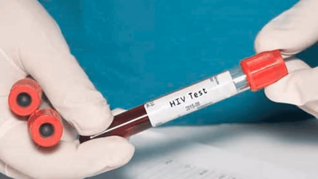 Mexiko will bis 2030 HIV als öffentliche Bedrohung beseitigen